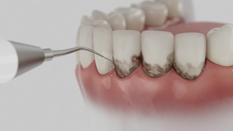 Reliable Dental Implants contractor in Edgerton, WI by Smile Center Dentistry